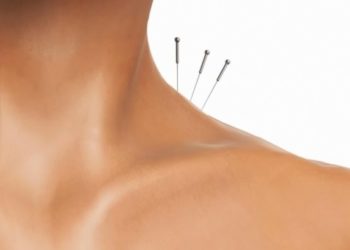 acupuntura