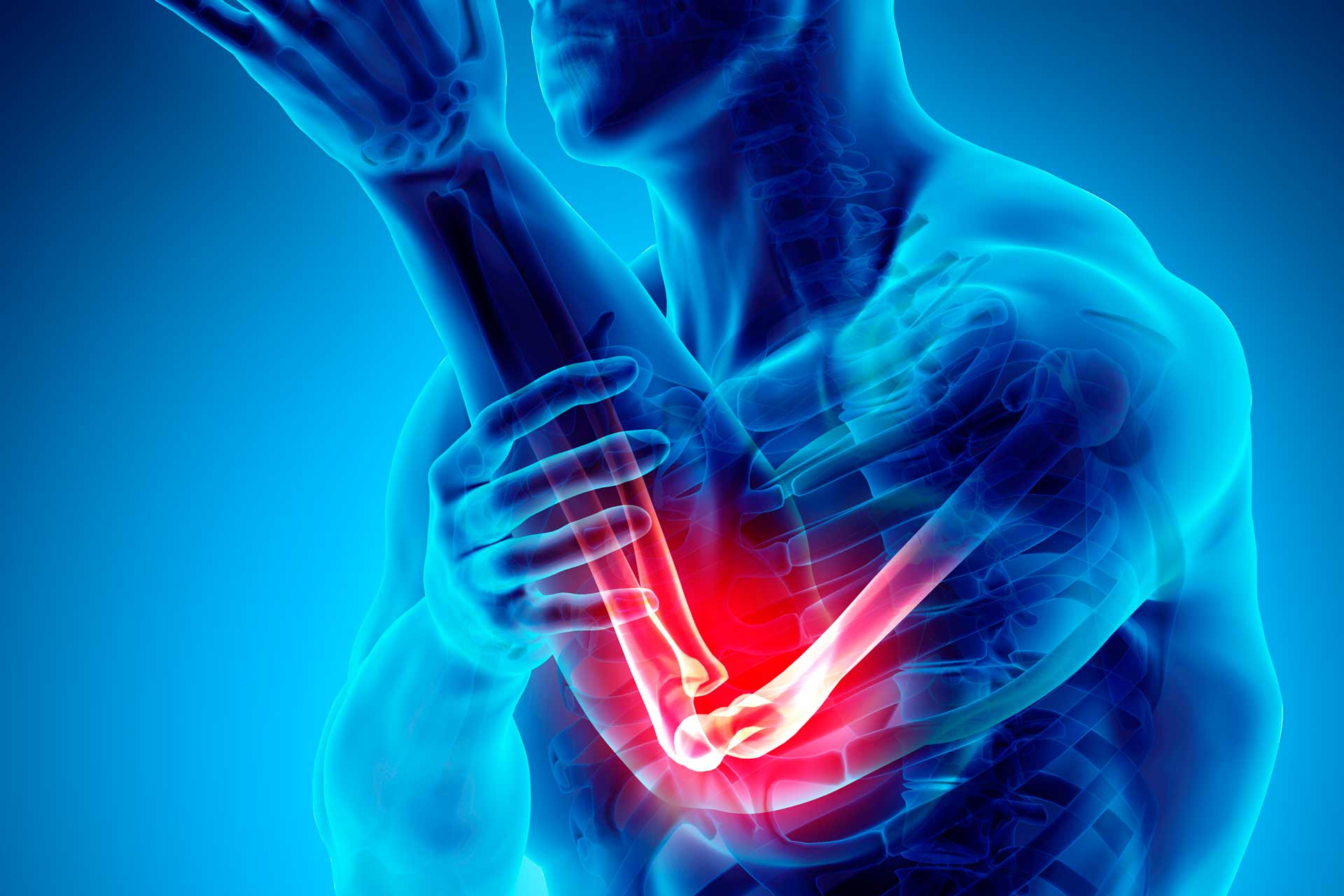 Epicondilitis codo de tenis lesiones tratamiento prevencion 1920